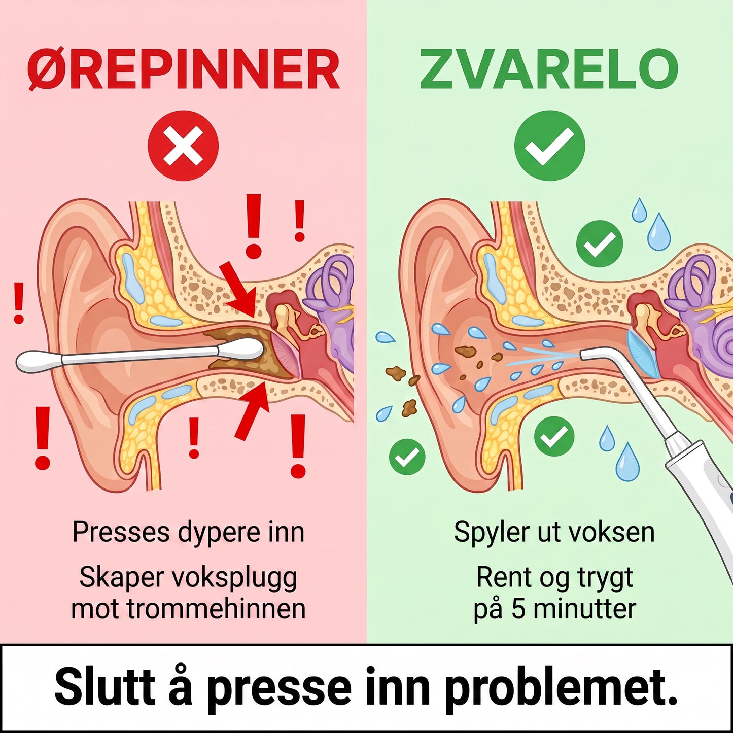 Orepinner vs Zvarelo