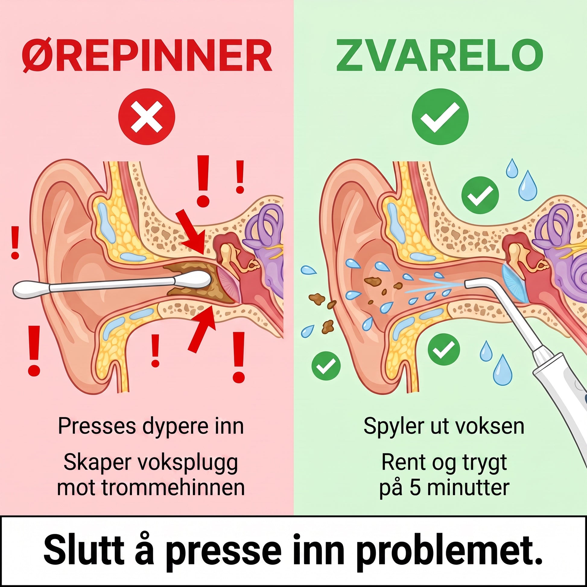Orepinner vs Zvarelo